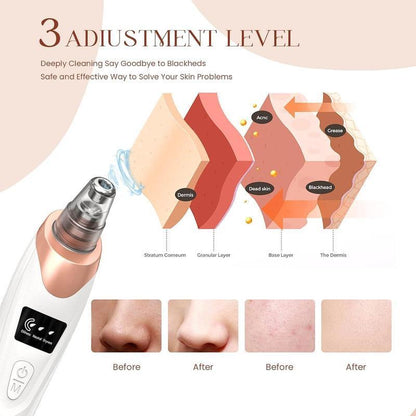 Blackhead Remover Vacuum Tool with 3 Adjustable Suction Levels & 5 Probes for Pore Facial Care, Ideal for Christmas Gifts
