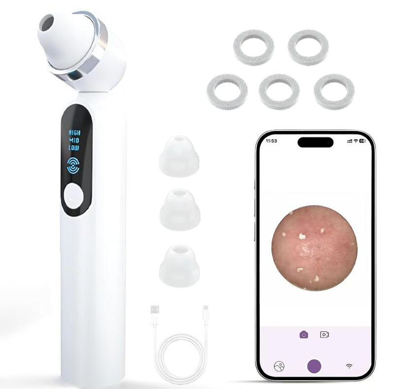 Visible Exfoliator Vacuum Cleaner, Skin Scrubber with Camera, Pore Cleaner with Three Modes, USB Rechargeable, Cleansing Skincare for All Gender