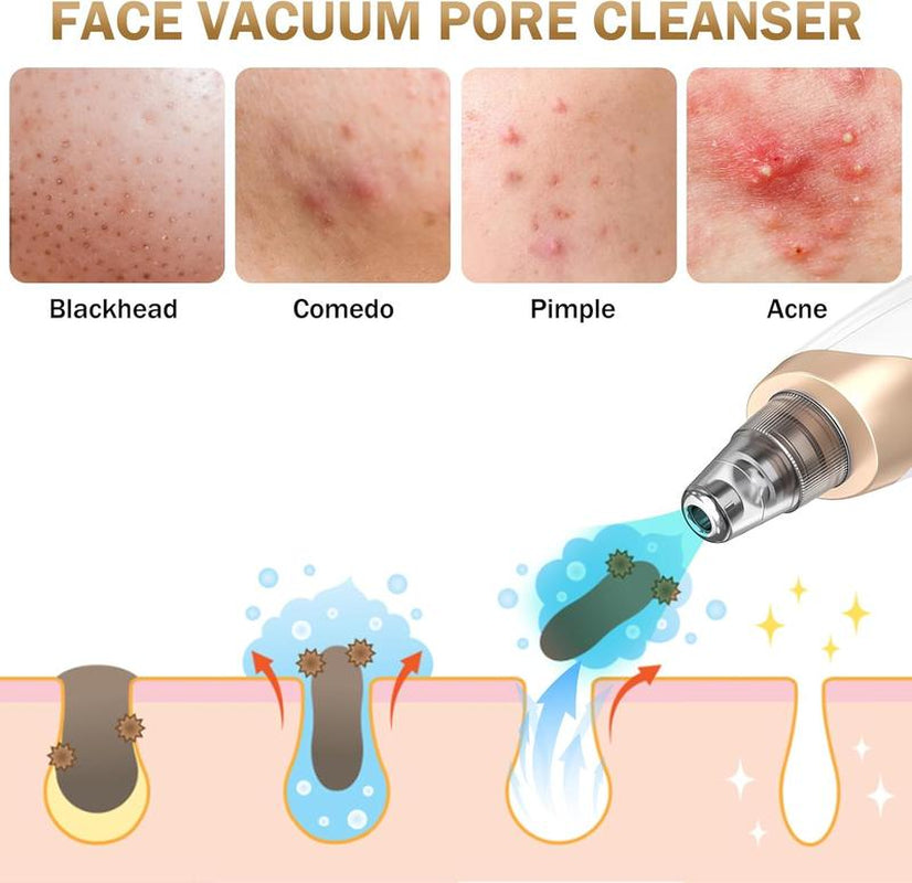 Blackhead Remover Vacuum Tool with 3 Adjustable Suction Levels & 5 Probes for Pore Facial Care, Ideal for Christmas Gifts